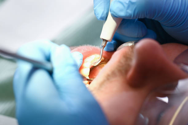Best Emergency Dental Care for Broken or Chipped Teeth in Strodes Mills, PA