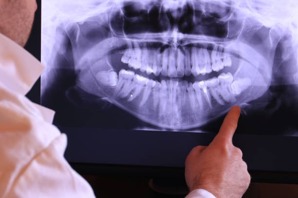 Best Emergency Dental Care for Broken or Chipped Teeth in Strodes Mills, PA
