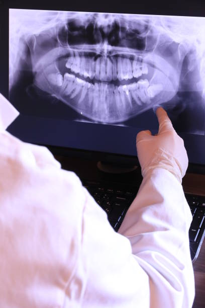 Best Emergency Gum Treatment in Strodes Mills, PA