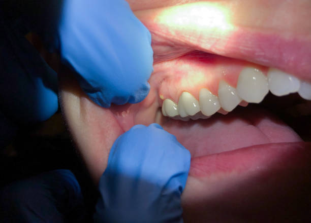 Best Cosmetic Emergency Dentistry in Strodes Mills, PA