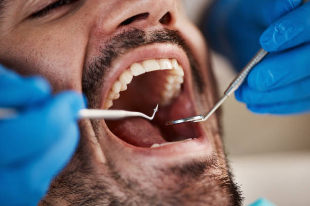 Best Emergency Denture Repair in Strodes Mills, PA